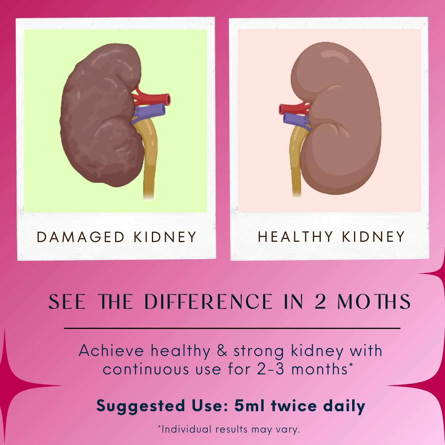 Kidney Detox & Cleanse Supplement (200ml) - Image 6