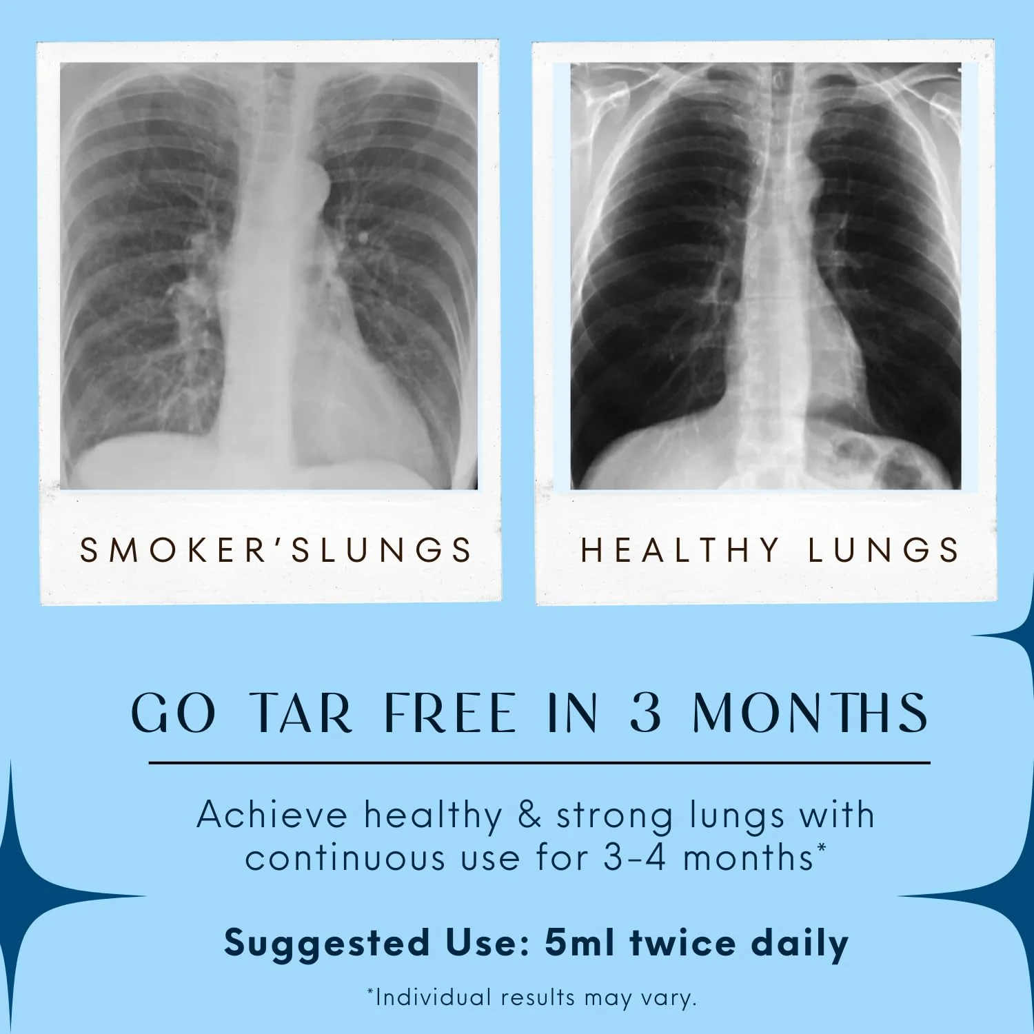 Lungs Detox - Image 4