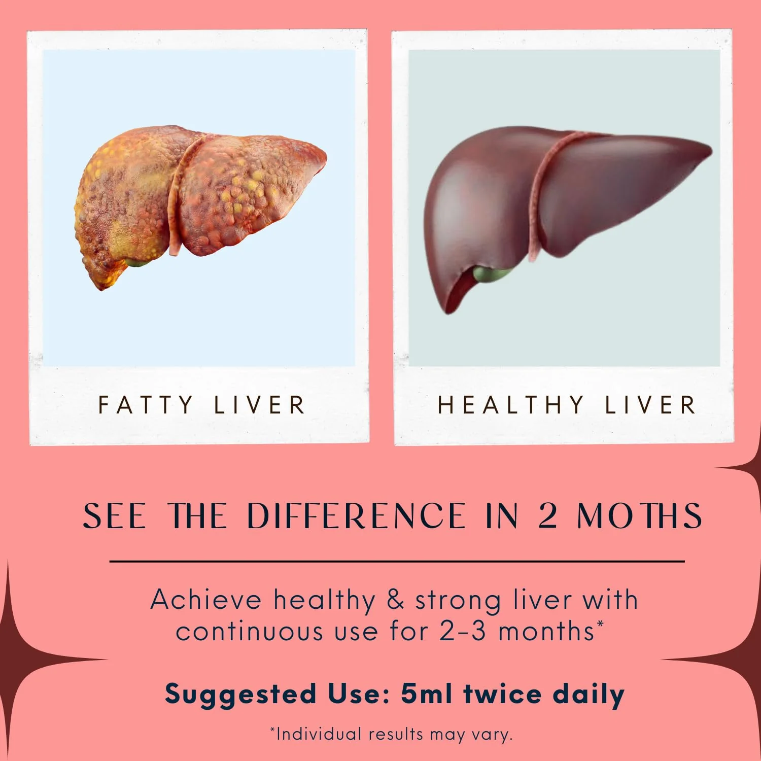 Natural Liver Detox Syrup - Image 2